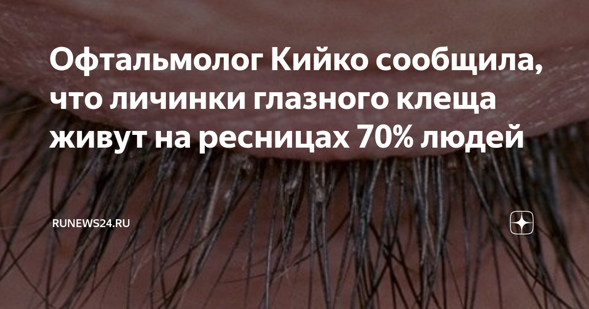 Глазной клещ у человека лечение фото признаки Патология придаточного аппарата глаза: виды, причины, способы лечения презента