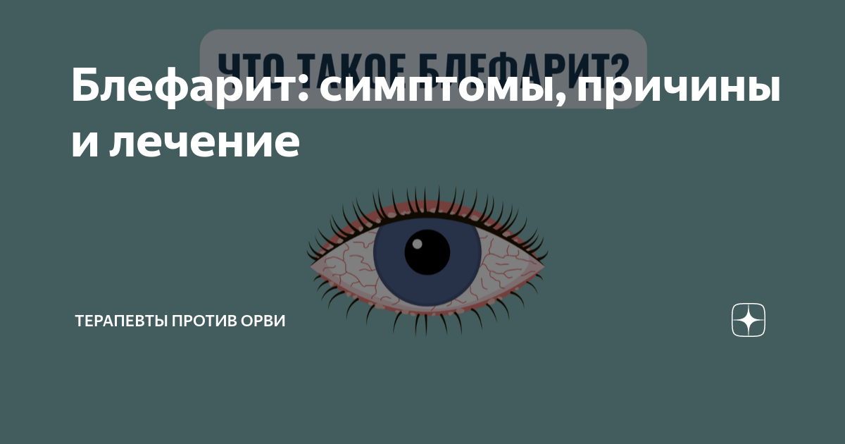 Блефарит: симптомы, причины и лечение Терапевты против ОРВИ Дзен