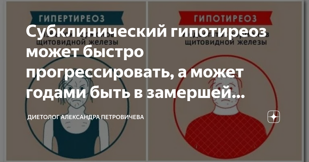 Субклинический гипотиреоз может быстро прогрессировать, а может годами ...