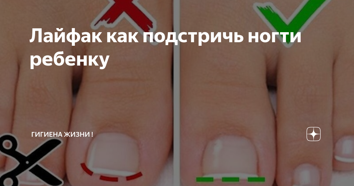 Как правильно стричь ногти ребенку на руках. Как правильно стричь ногти ребенку на руках