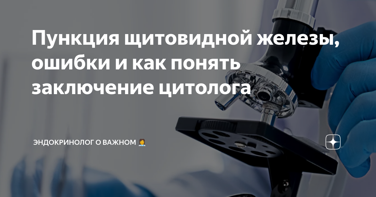 Пункция щитовидной железы, ошибки и как понять заключение цитолога ...
