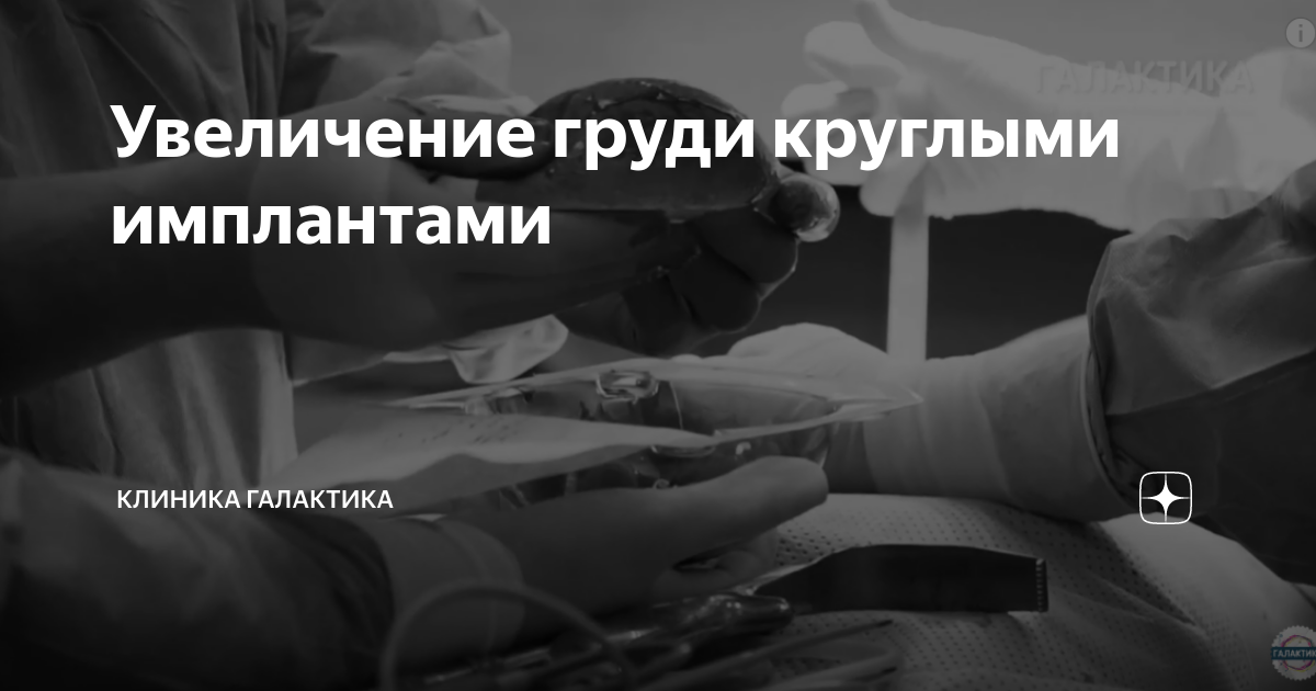 Увеличение груди круглыми имплантами | Клиника ГАЛАКТИКА | Дзен