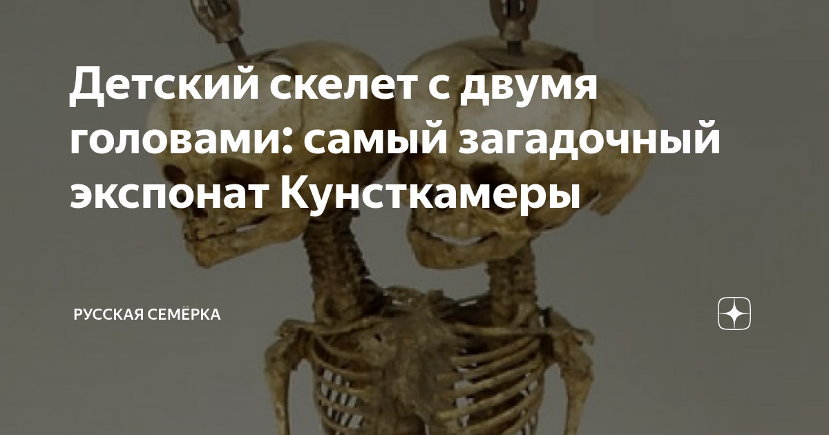 Детский скелет с двумя головами: самый загадочный экспонат Кунсткамеры ...