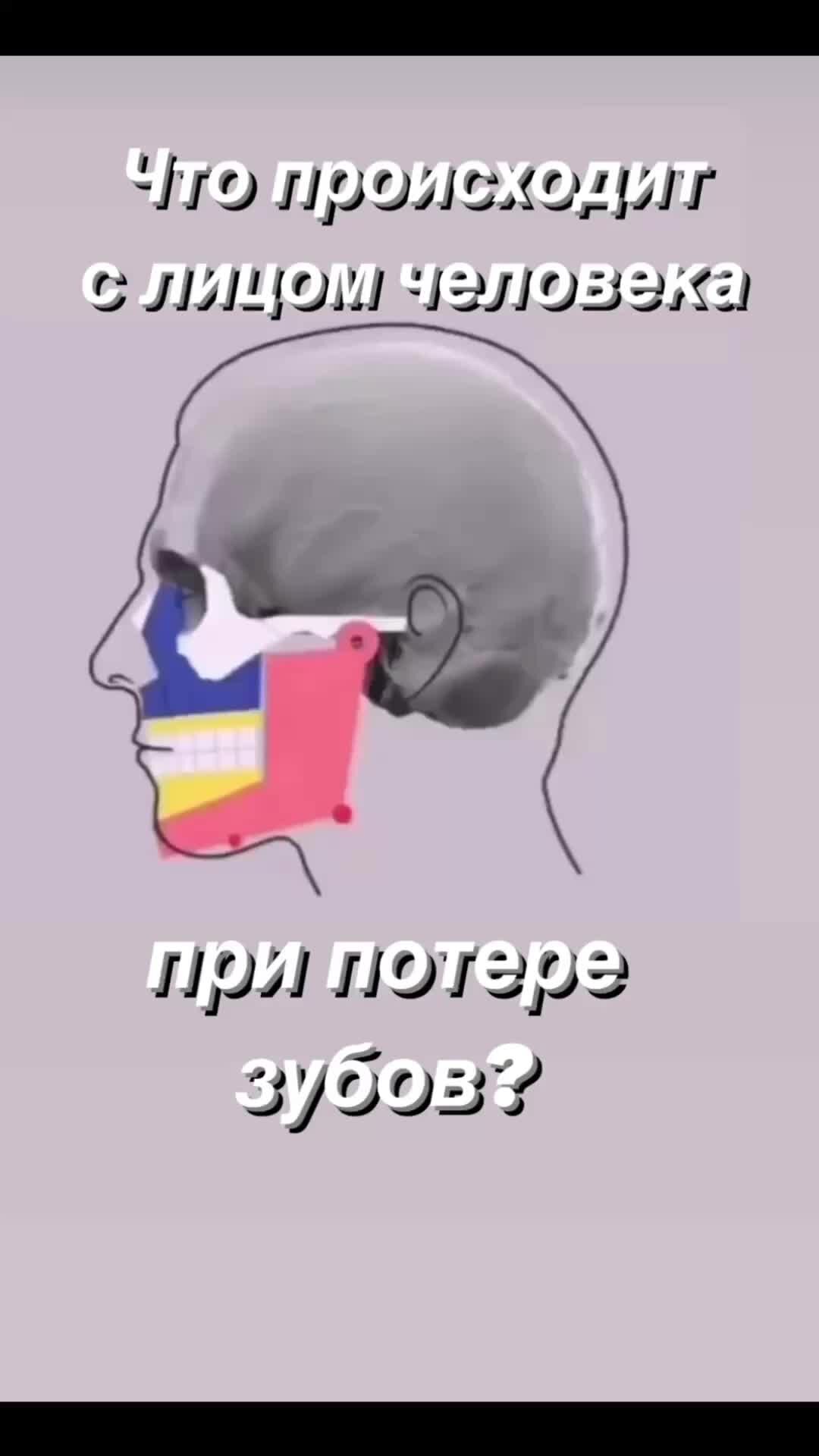 Стоматолог Кондрашова | Что происходит с лицом человека при потере зубов?  Наглядное видео | Дзен