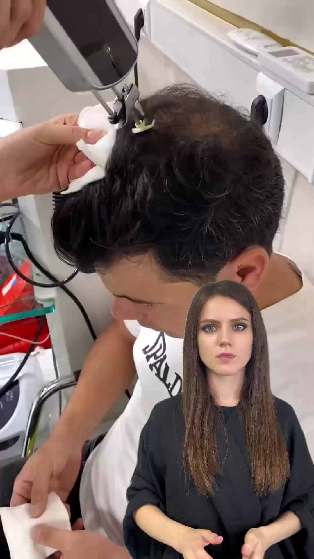 Мужские системы волос | Мезотерапия и плазмотерапия для волос -стоит ли ...