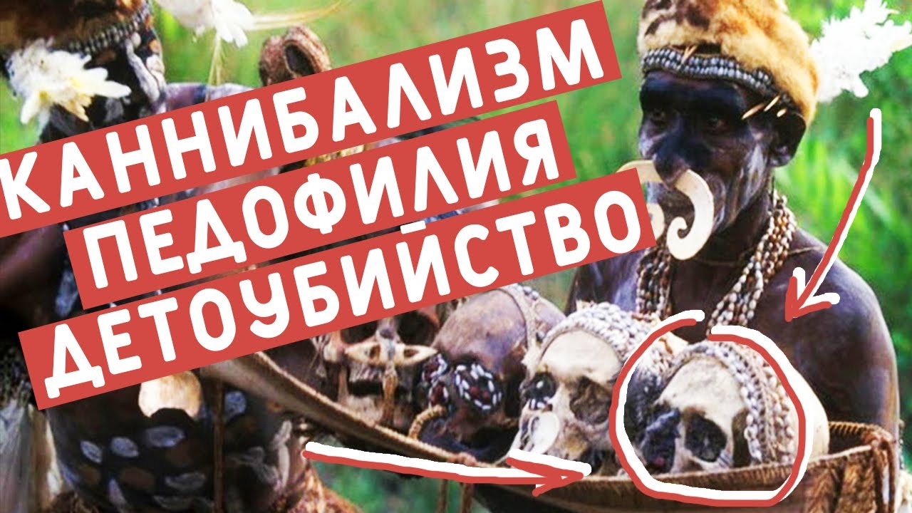 Болезнь куру пути передачи. Болезнь куру улыбка канибала. Болезнь куру описание фото. Болезнь куру улыбка канибала. Болезнь куру улыбка канибала.