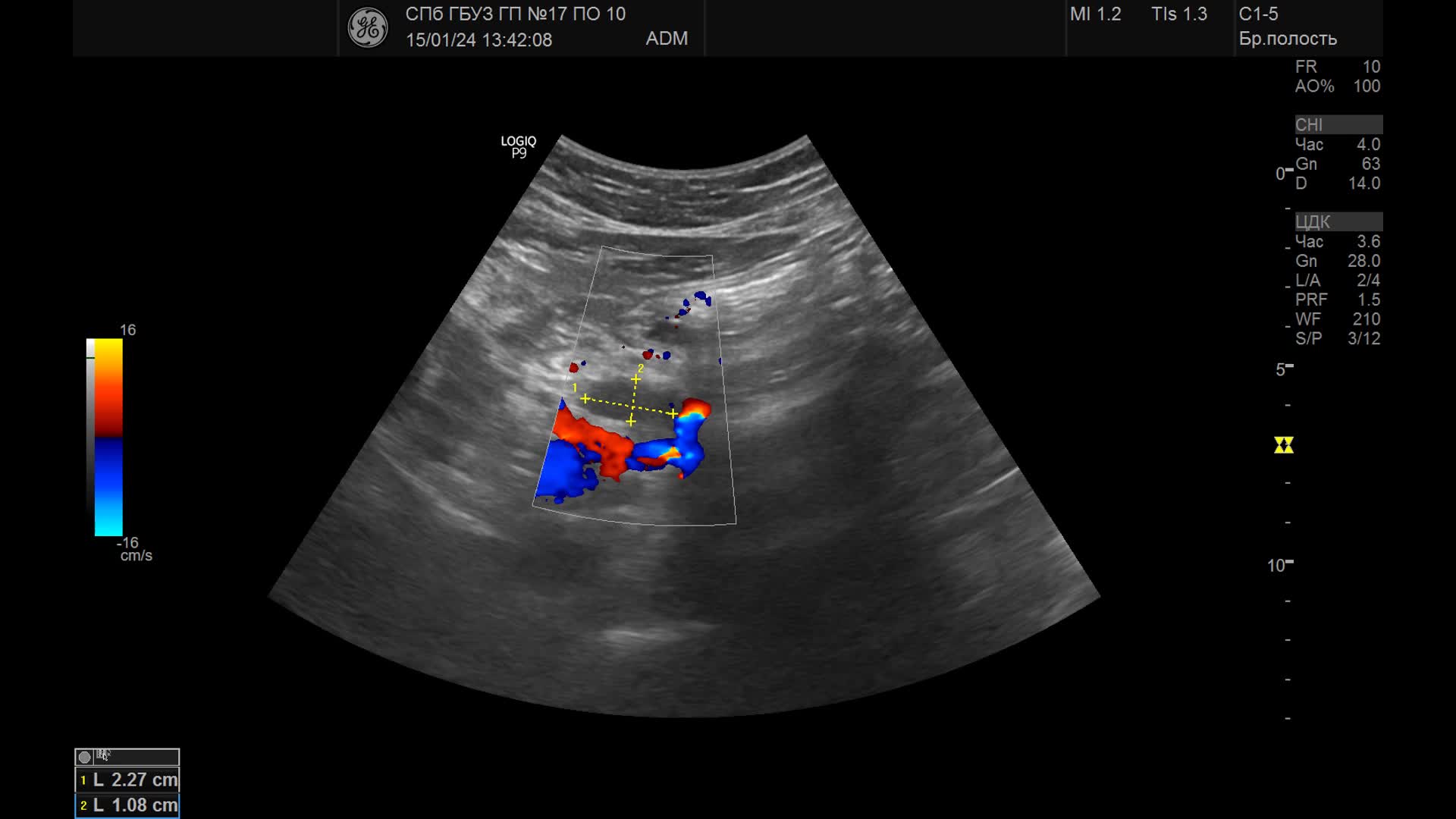 Хронический билиарный панкреатит. Какой врач лечит печень и поджелудочную железу. Острый и хронический панкреатит. Хронический панкреатит характеризуется. Поджелудочная анатомия.