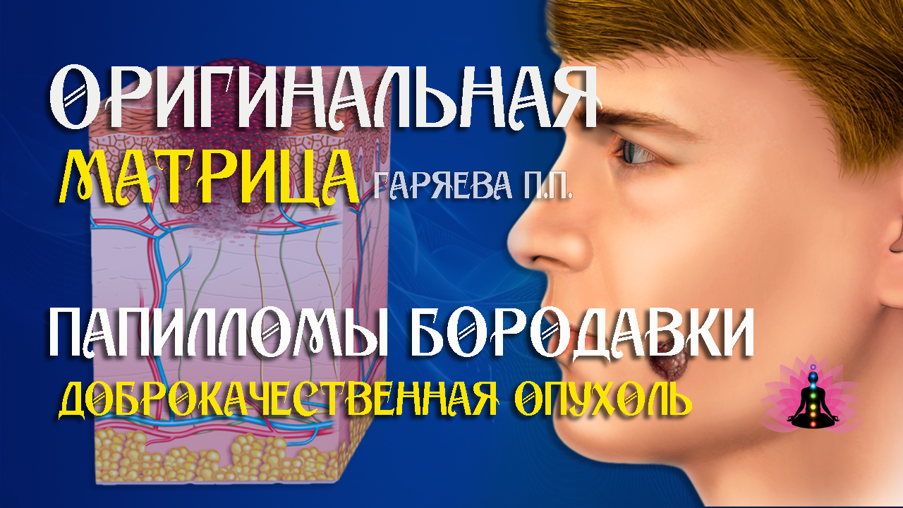 Матрица от папиллом