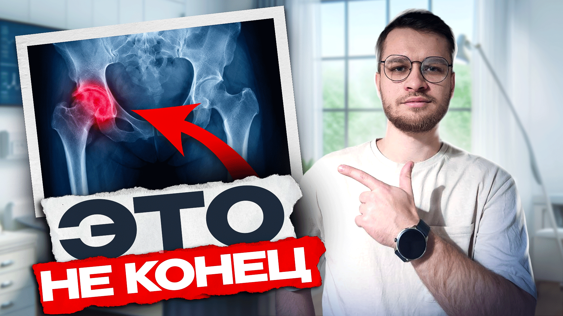 санаторий перелом шейки бедра