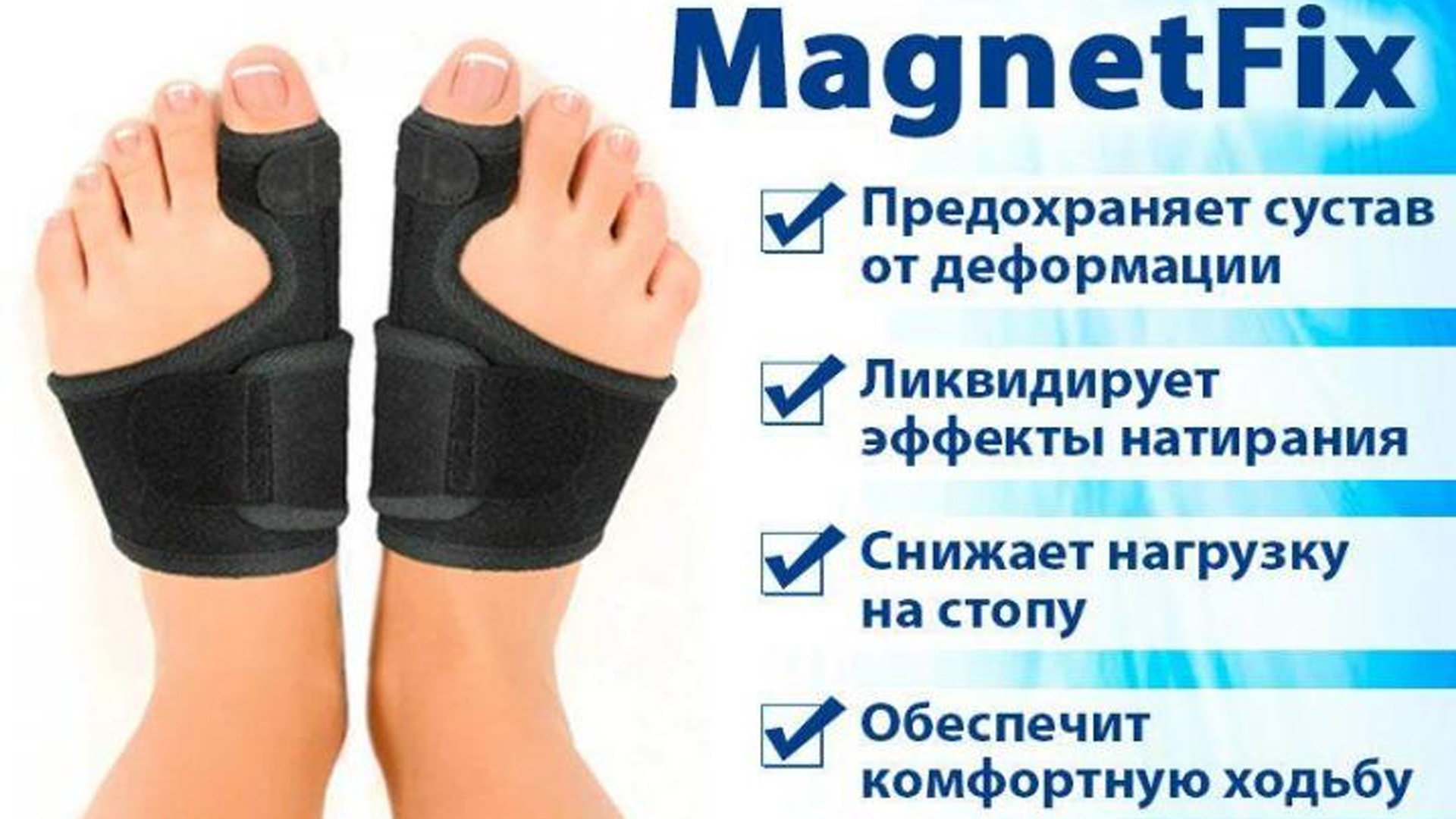 Подагра большого пальца ноги. Бурсит плюснефалангового сустава большого пальца. Бурсит 1 плюснефалангового сустава. Стопа. Подагрический артрит плюснефалангового сустава.