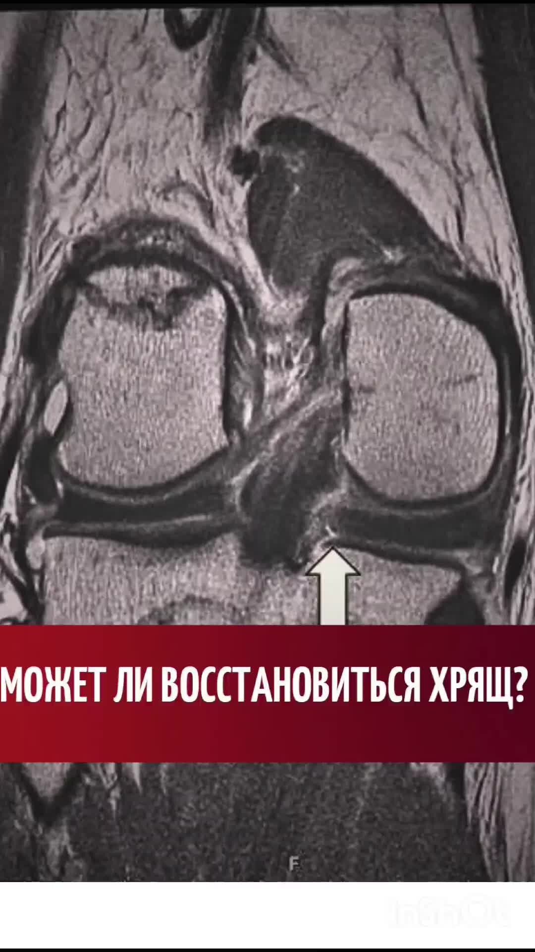 Можно ли восстановиться в другой. Можно ли восстановиться в другой