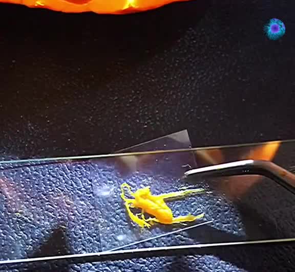 Под микроскопом представили. Кристаллы гидроксиапатита. Кристаллы гидроксиапатита в костной ткани. Кожа человека под микроскопом. Трабекулярное вещество кости гистология.