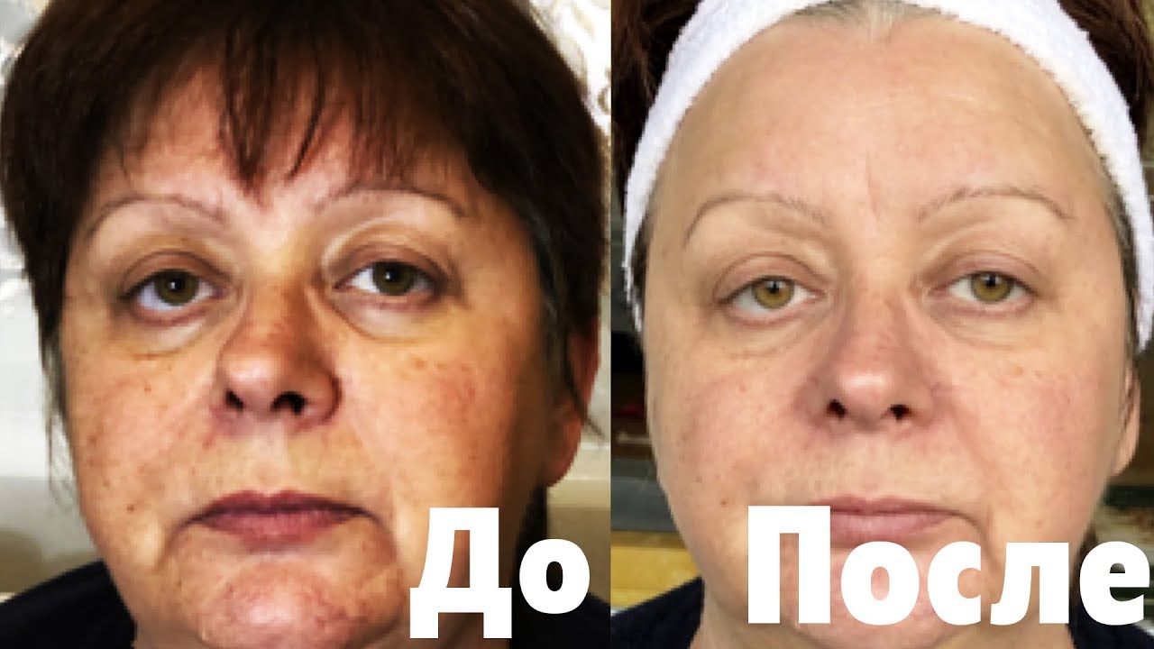 Увядающая кожа картинки. Крем для лица. Уход лицом после 55. Уход лицом после 55. Макияж для женщины 50 лет.