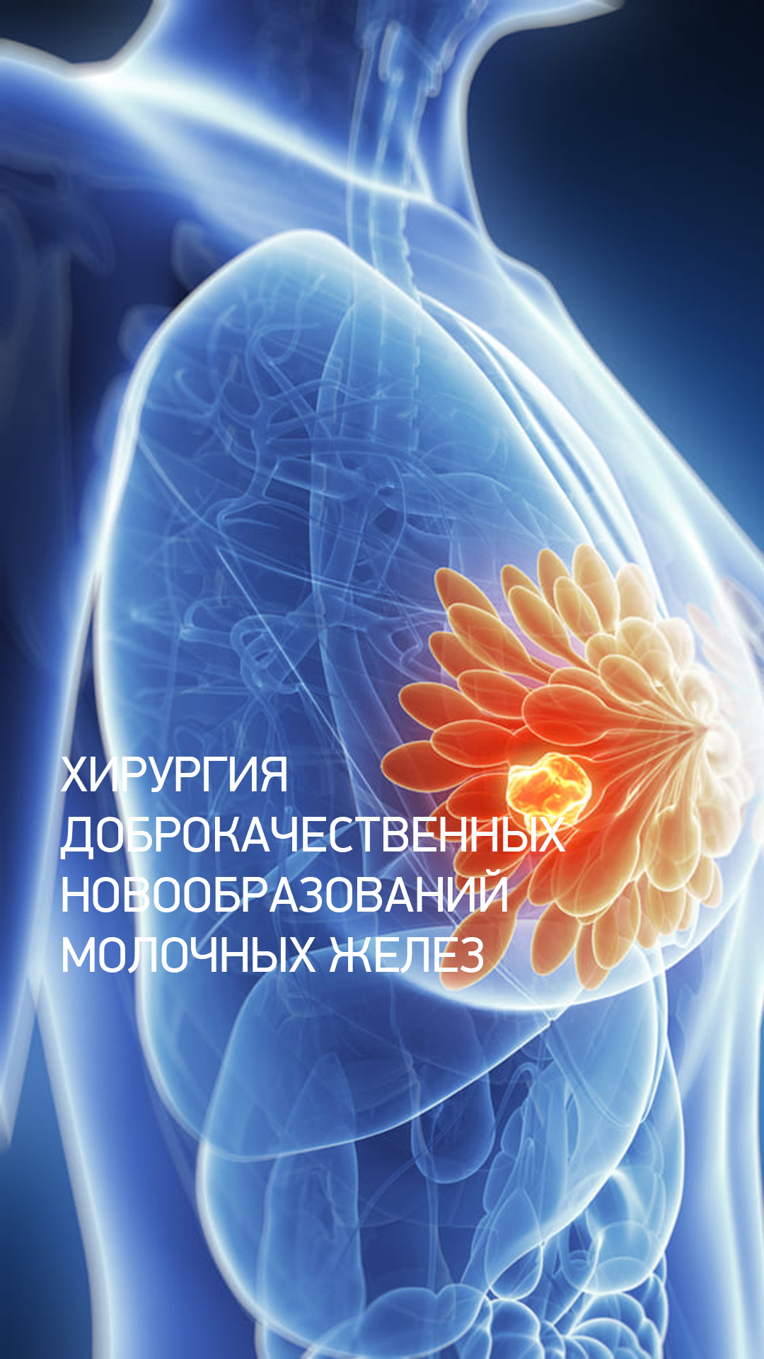 онкологическое лечение молочных желез. опухольмолочныйжелезы. злокачественные новообразования молочных желез клиника. онкологическое лечение молочных желез. раковые клетки молочной железы.