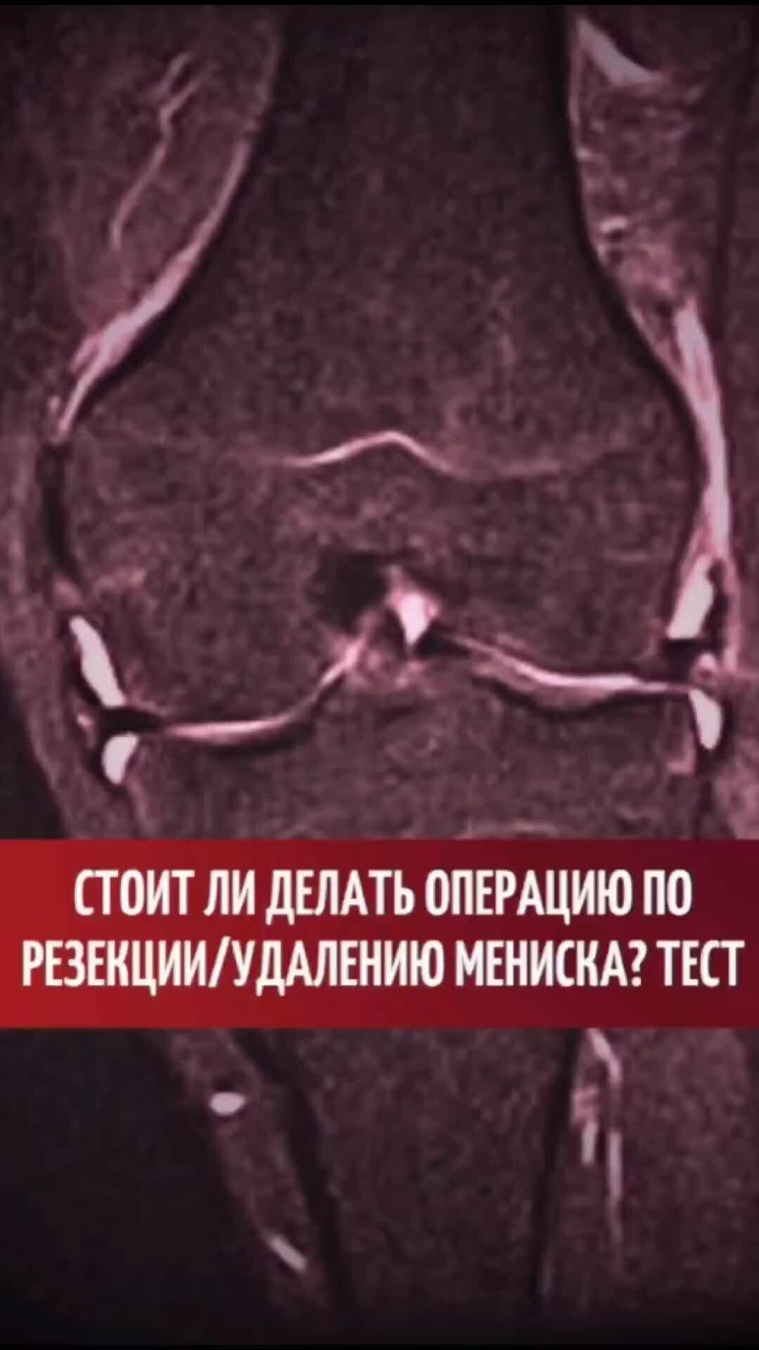 Спинальная анестезия снижение ад. Гипотоник артериальное давление таблица. Показатели повышенного давления. Делают ли операции при давлении. Делают ли операции при давлении.