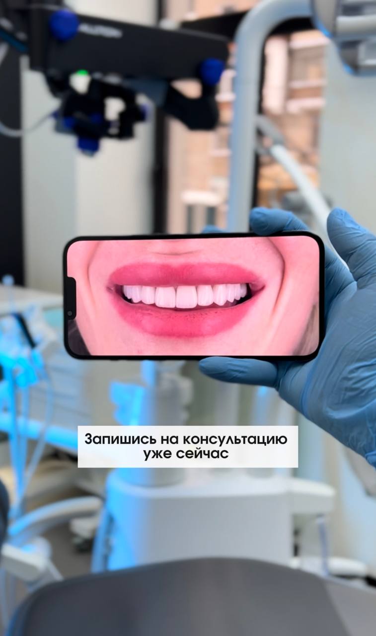 Как получить smile. Как получить smile