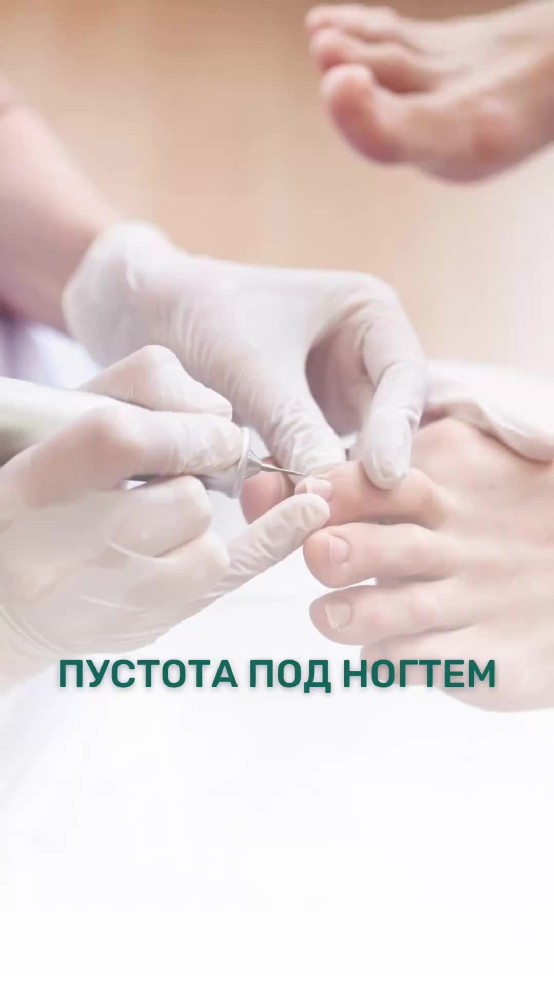 Подолог /педикюр Санкт-Петербург | Пустота под ногтем. На сайте podolog ...