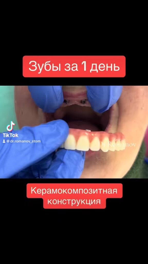 Зубы за 1 день. Зубы за 1 день