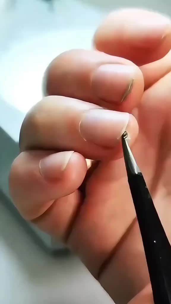 Микроскоп ногтей