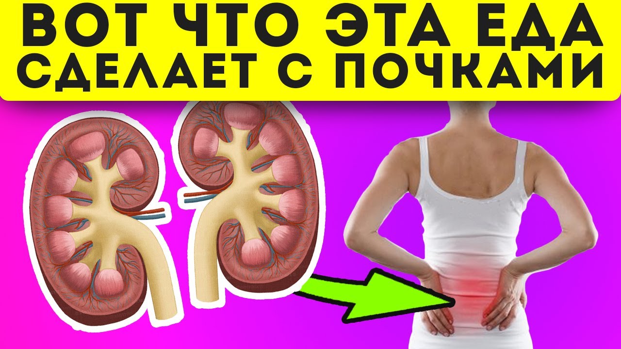 Выполняет функцию фильтра. Выполняет функцию фильтра