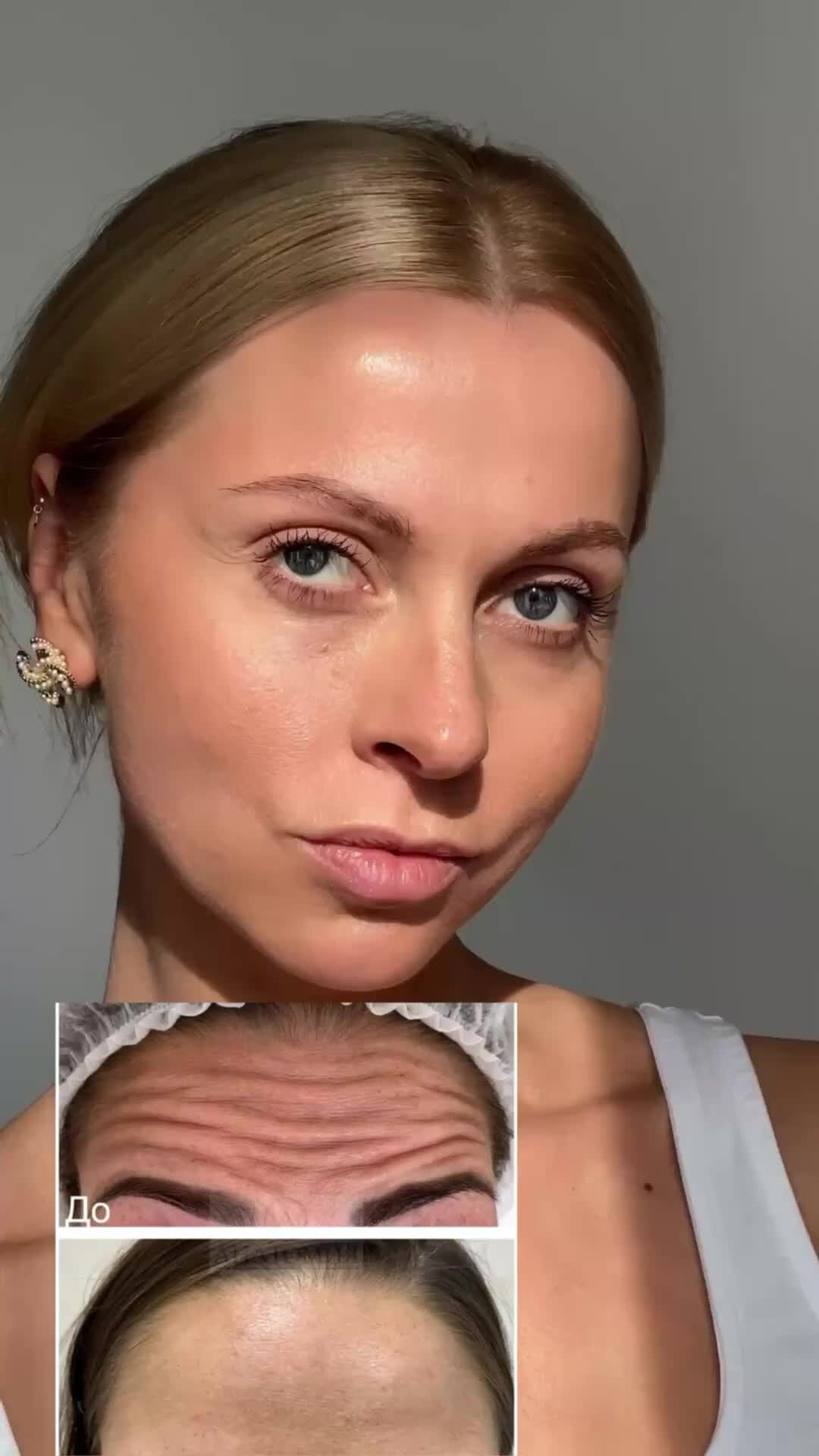datskaya.beauty | ИДЕАЛЬНЫЙ ЛОБ без морщин 🤗 да да этого можно добиться ...