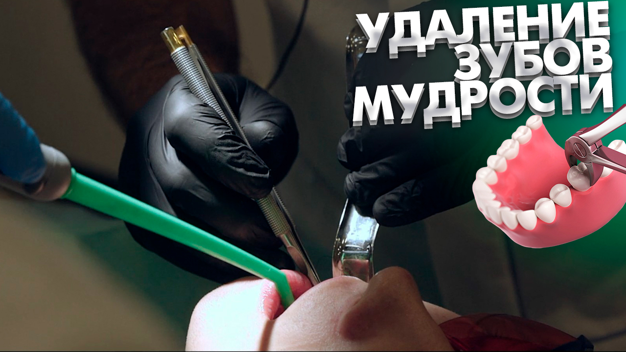 21 век записаться к врачу. Записаться к врачу. Запись на приём к врачу на госуслугах. Моё здоровье записаться к врачу. Программа регистратура поликлиники.