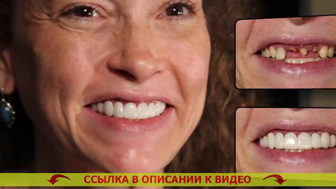 зубы стоят дорого