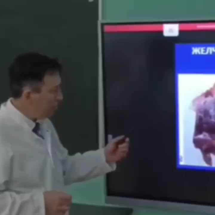 Дуодено гастральный рефлюкс терапия. Как удалить желчь из желудка. Заброс желчи в желудок лекарства. Препарат от заброса желчи в желудок. Дуоденально-гастральный рефлюкс желчи.