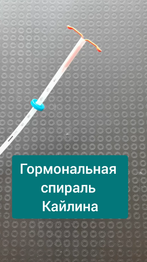 Кайлин или мирена. Мирена и Кайлина спирали. Гормональная спираль. Спираль Кайлина внутриматочная. Гормональная спираль Кайлина.