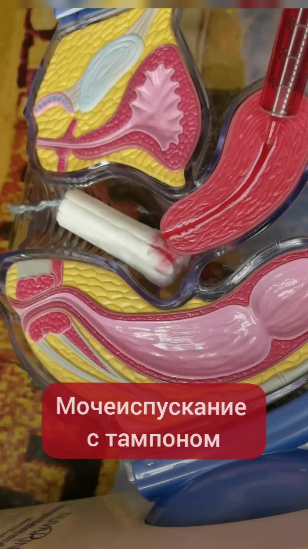 Джентльмен с тампоном в руке