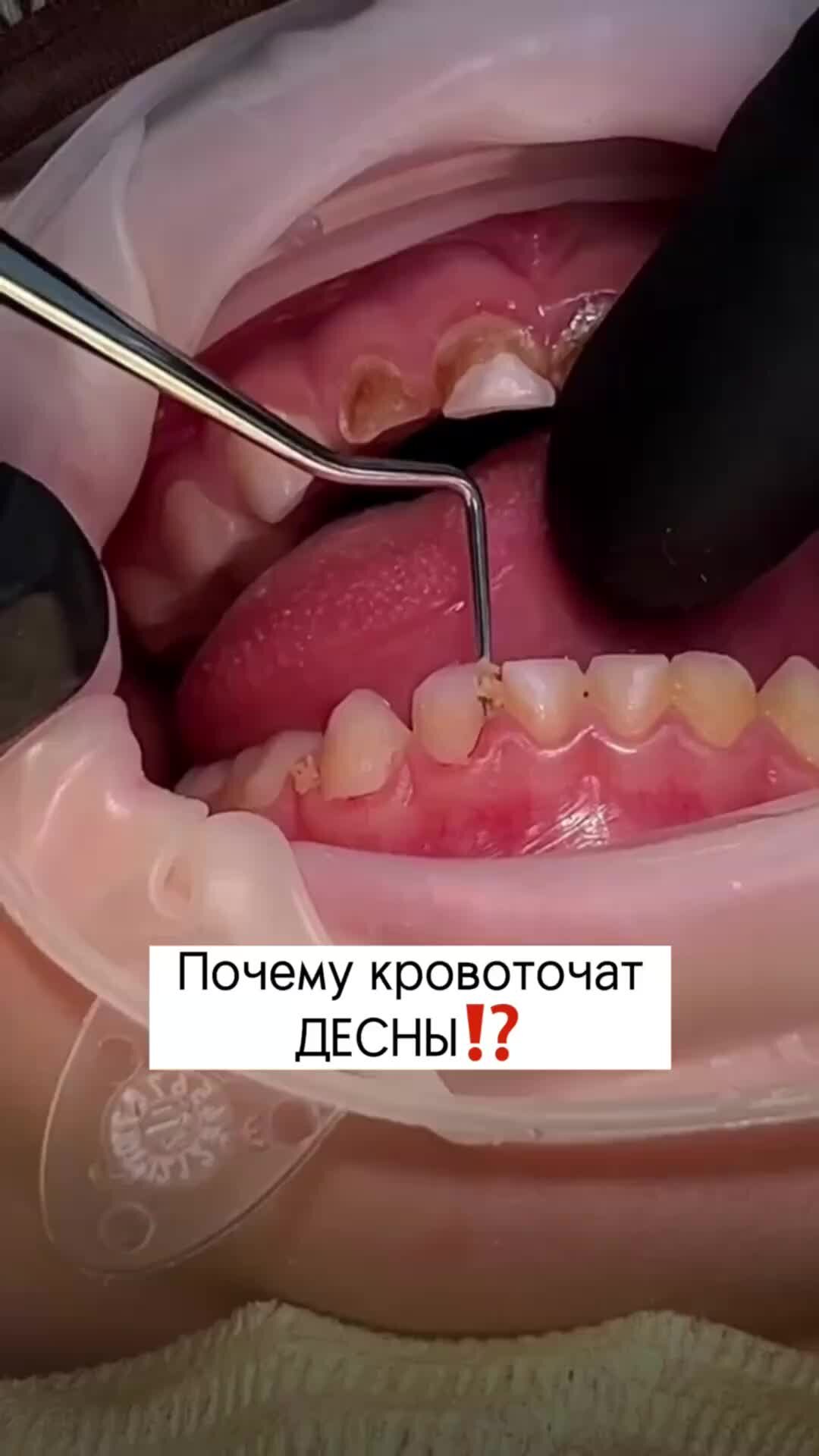 Стоматология ЛИКС ДЕНТ | Подписывайся! Стоматология в СПБ - ЛИКС ДЕНТ🧡 ...