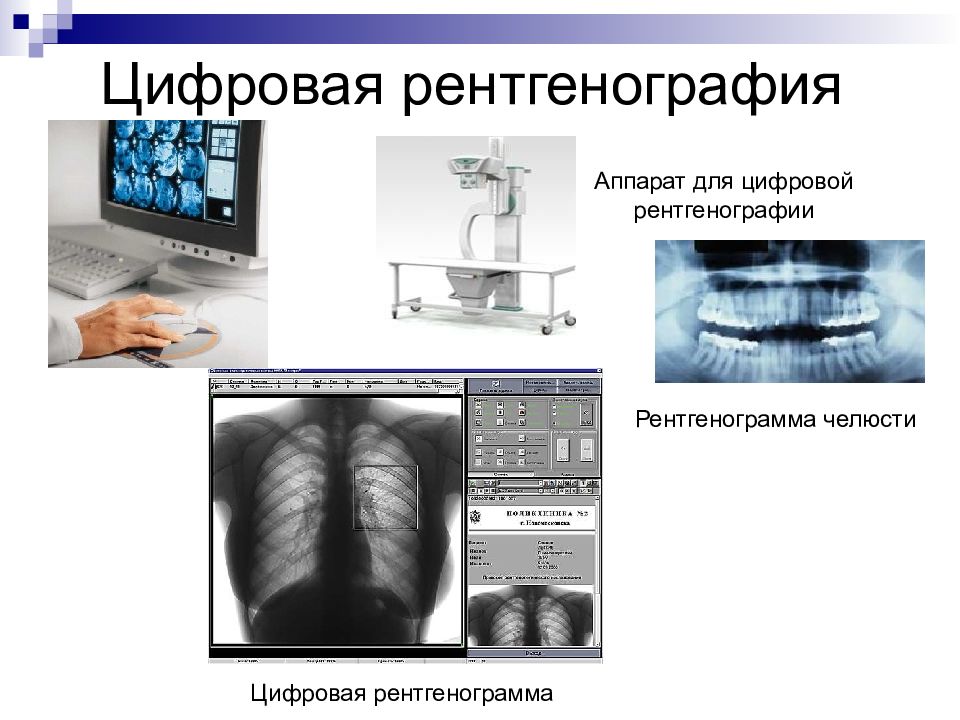 Изображение получаемое на рентгеновской пленке