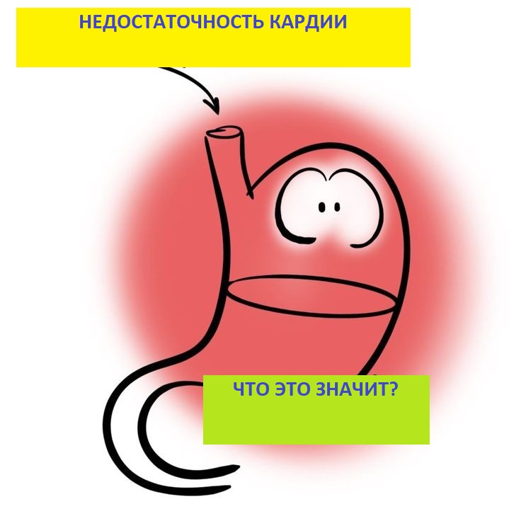 Недостаточность кардии степени. Недостаточность кардии. Недостаточность розетки кардии. Недостаточность кардии 1 степени. Поверхностный гастрит недостаточность кардии что это