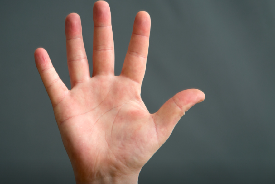 редкие руки. (обезьянья линия, линия симиан). редкие руки. хиромантия линии на руке. линия симиан синдром дауна.