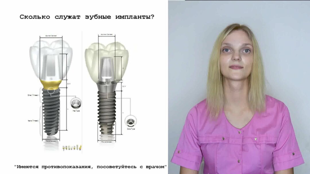 Inno импланты. Экспресс имплантация зубов. Срок службы импланта зуба. Срок службы импланта зуба. Срок службы импланта зуба.