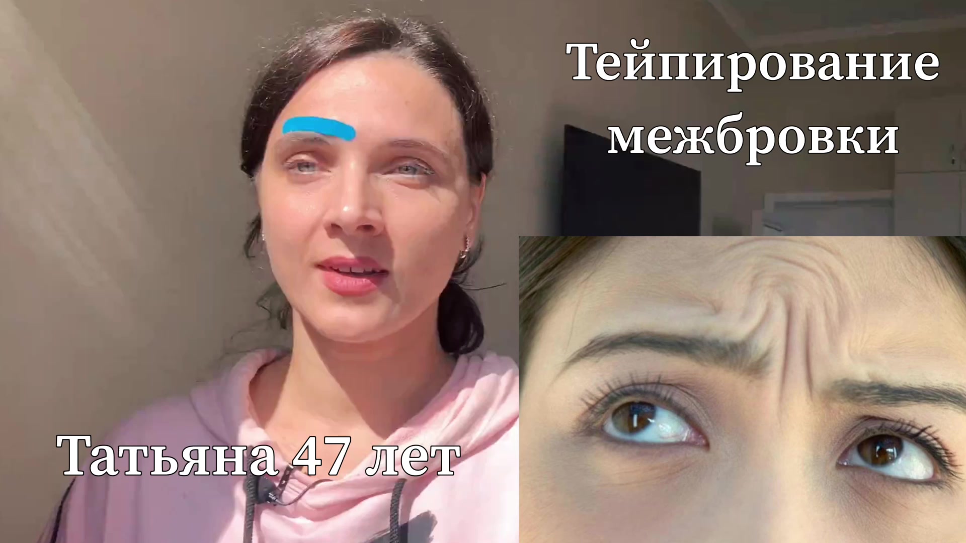 Межбровка тейпирование схема