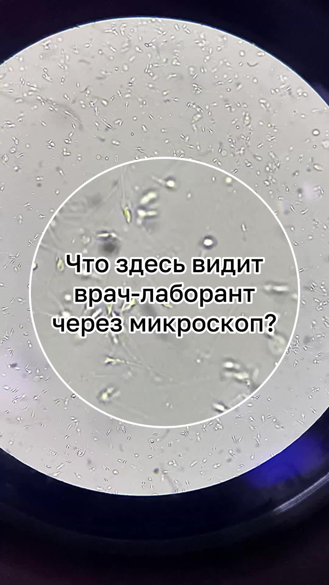 Catch the Sperm — Википедия