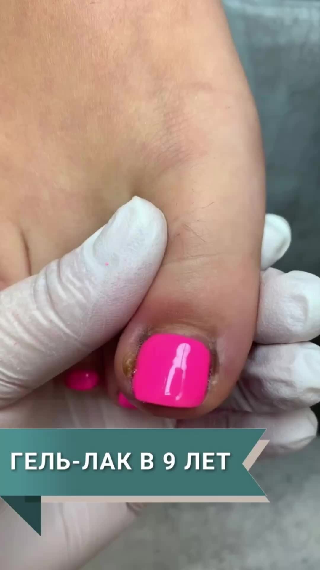 Medped.ru | В 9 лет проблемы взрослой женщины | Medped | Врос ноготь ...