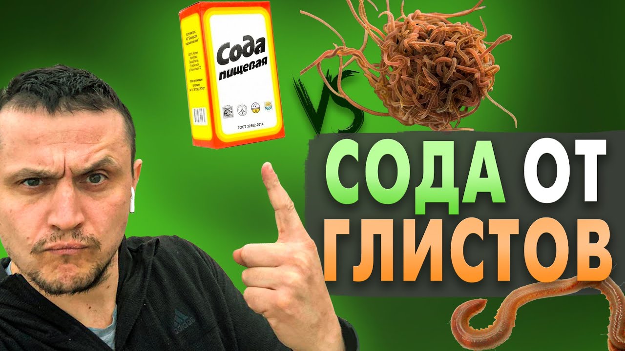 Сода от глистов и паразитов. Чистка от паразитов содой.