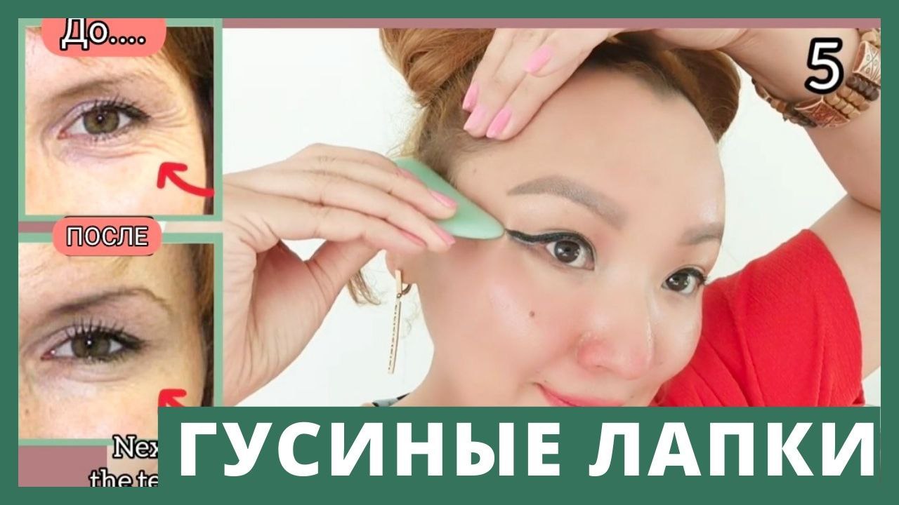 Как избавиться от гусиных