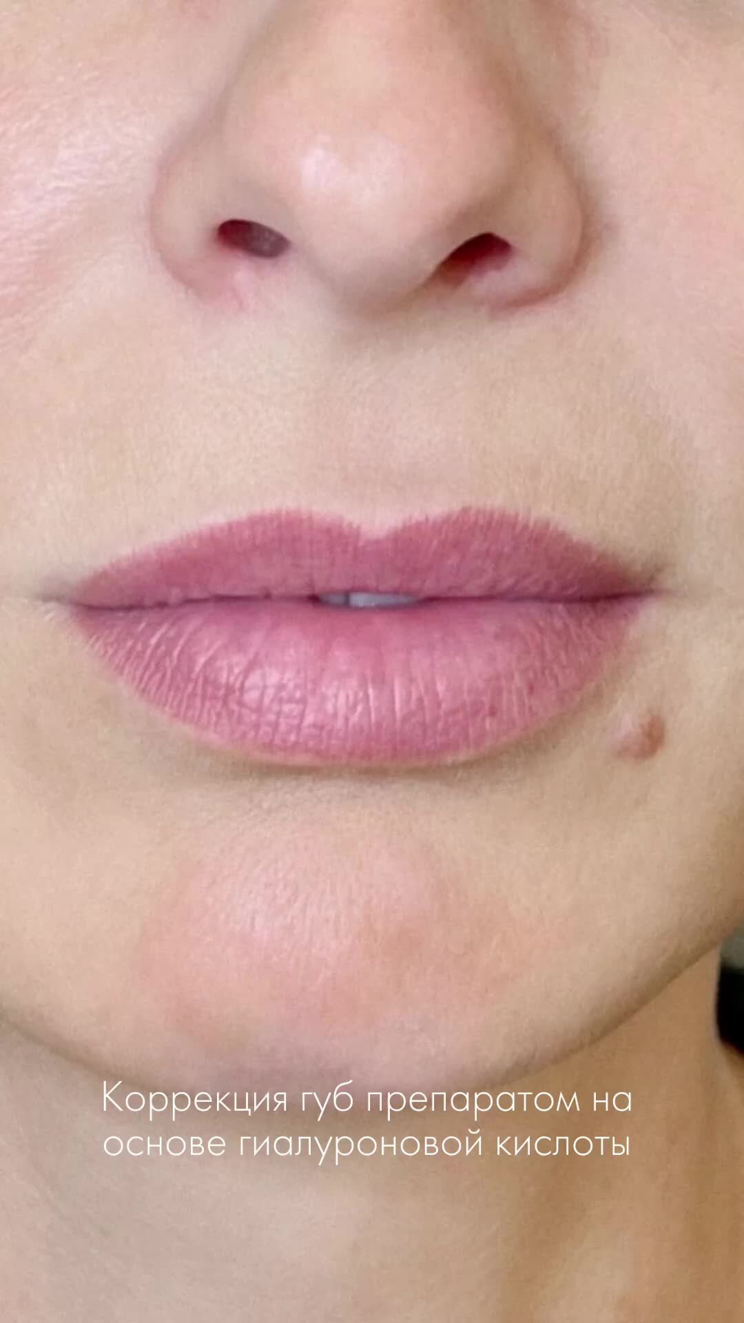 Гомеопатия губы. Гомеопатия губы. Гомеопатия сырье. Гомеопатия губы. Гомеопатия губы.