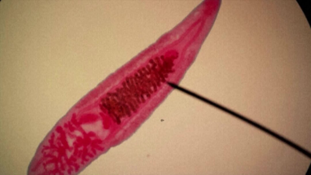 Описторхоз. Сибирская двуустка профилактика.