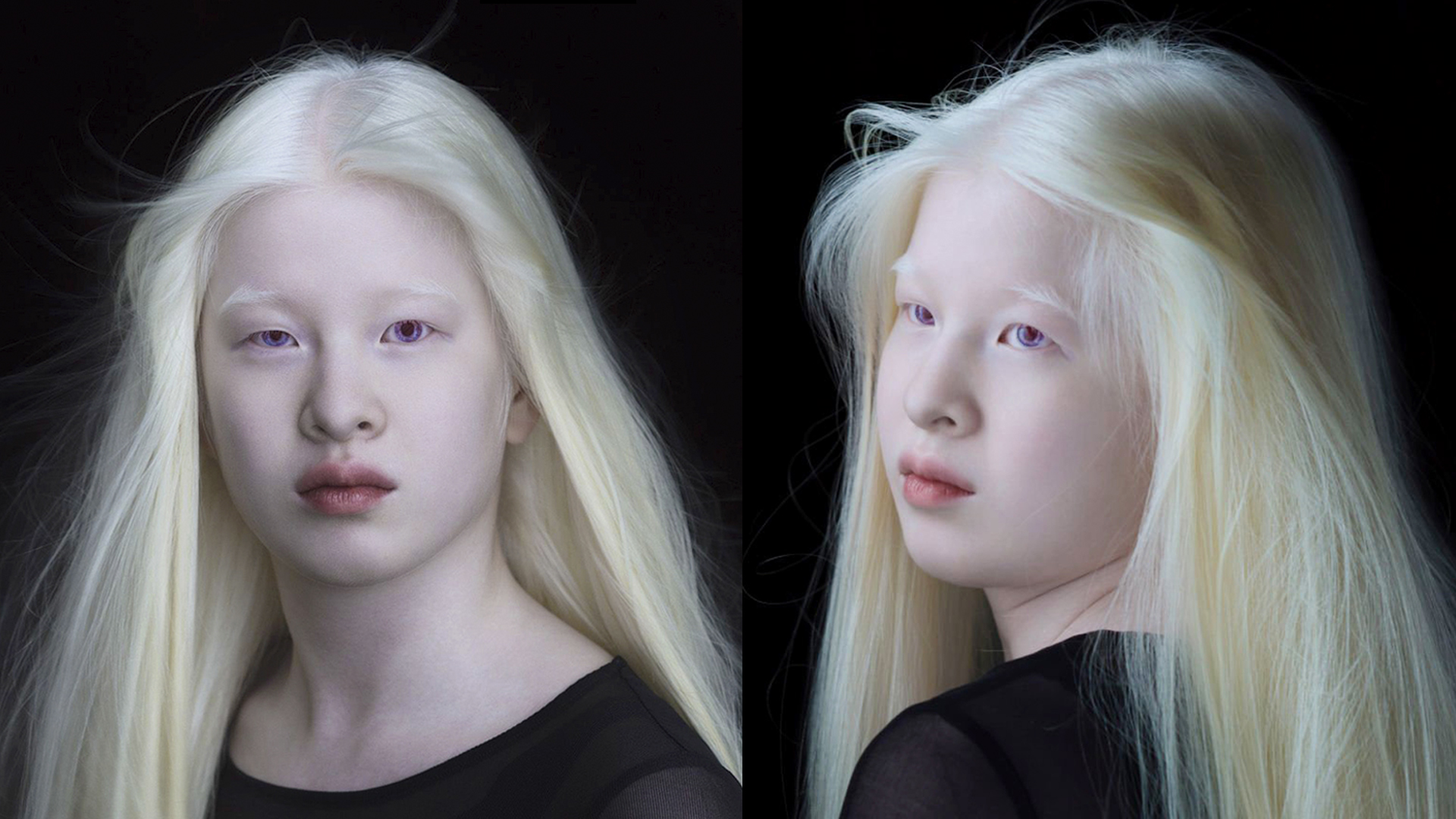 негр и азиат альбинос фото 48