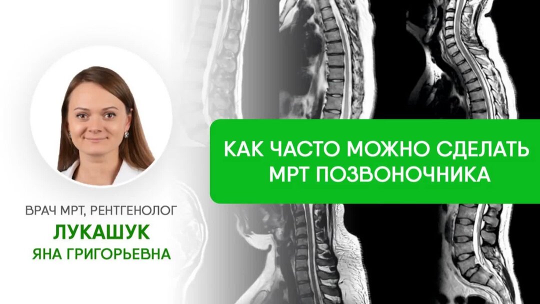 Как часто можно делать мрт. Мрт онкопоиск. Кт и мрт позвоночника разница. Онкопоиск мрт всего тела что показывает.