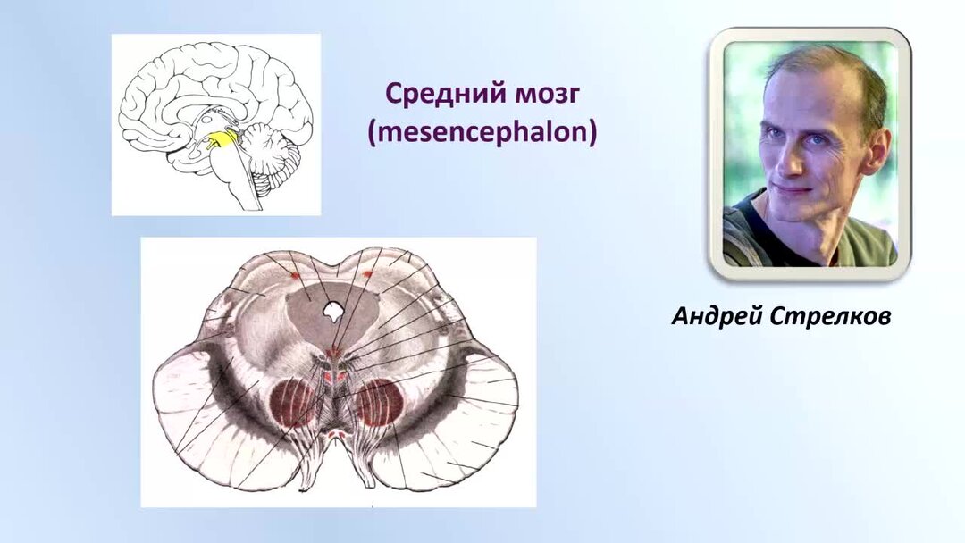 Тест мозга 4. Средний мозг на кт.