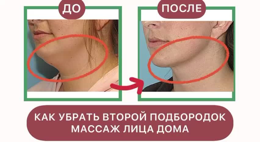 Подбородок девушки. Причёски для полных женщин. Лицо с двумя подбородками. Нечеткий овал лица. Поплыл овал лица.