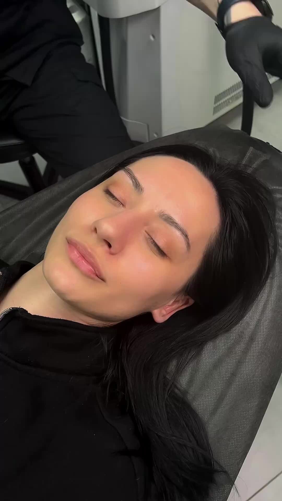 Удаление татуажа и тату по методу Цедермана | лазерное удаление татуажа ...