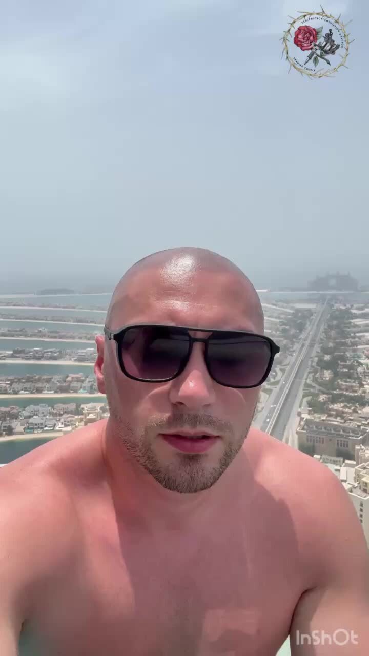 Трихопигментация.рф | Трихопигментация спустя несколько месяцев, полный ...