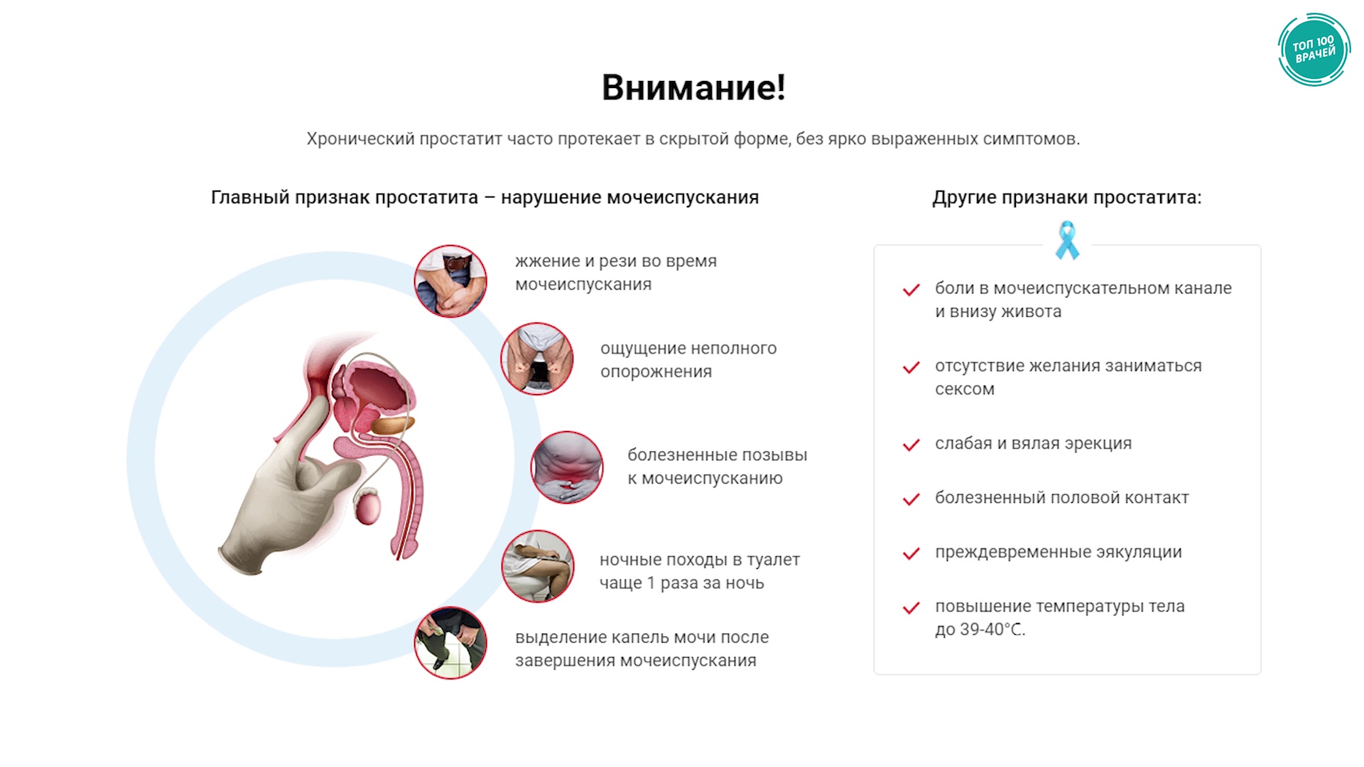 Симптомы хронического простатита