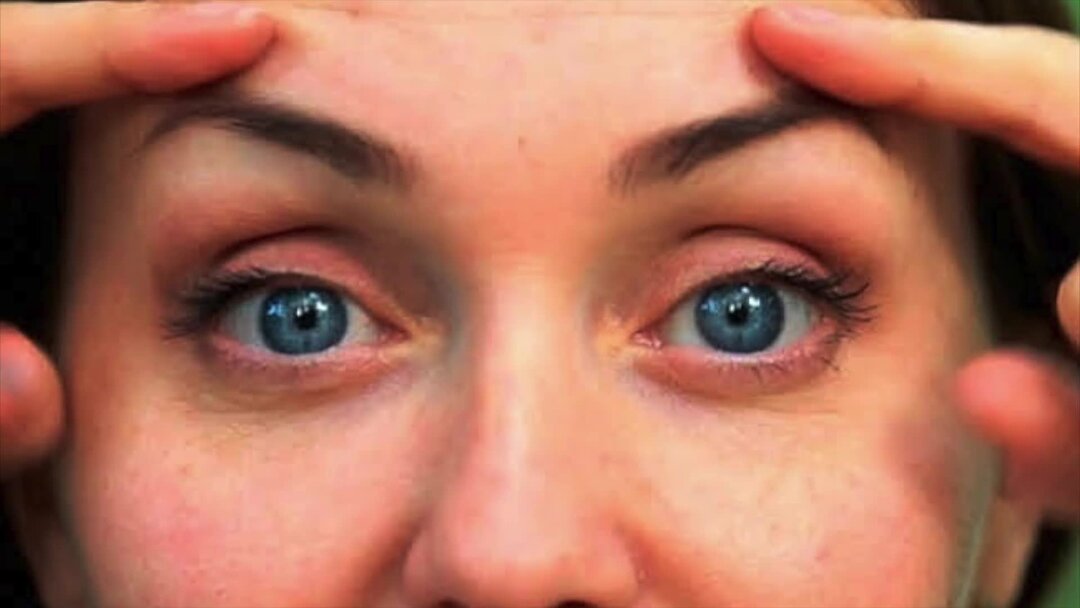 Веки нависают на глаза. Поднять веки. Внутреееый угол глаза накрашен. Опухлость верхнего века. Тяжелые веки причины.